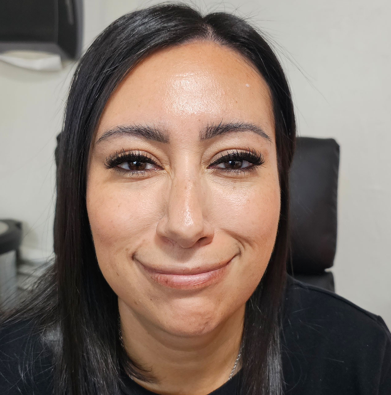 before-after